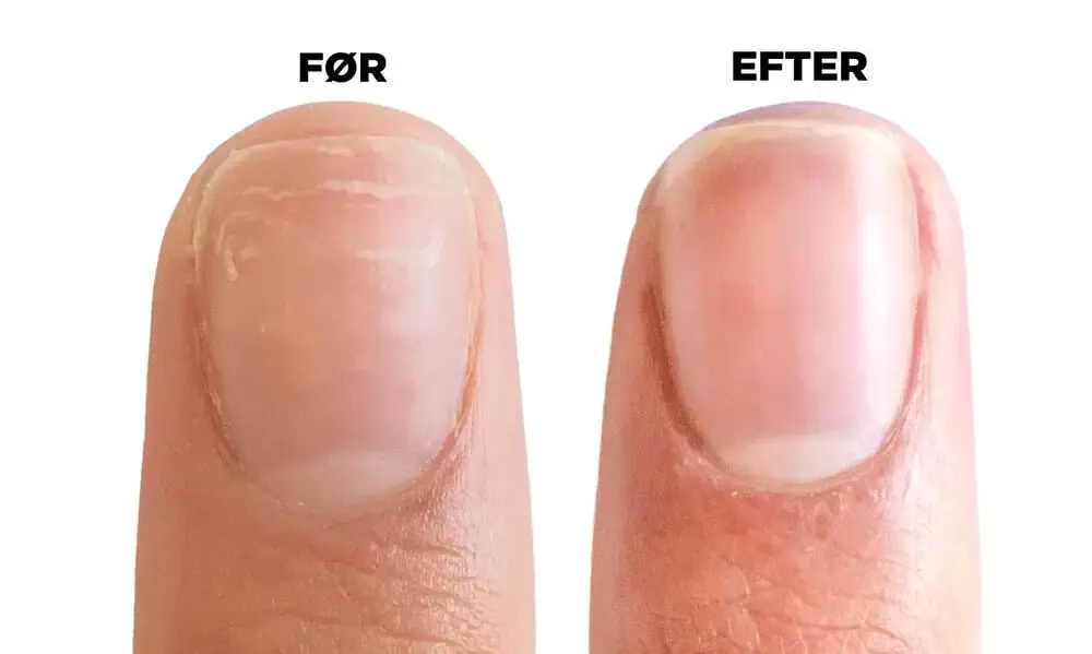 CND Rescue RXx Daily Nail Keratin Treatment 15ml