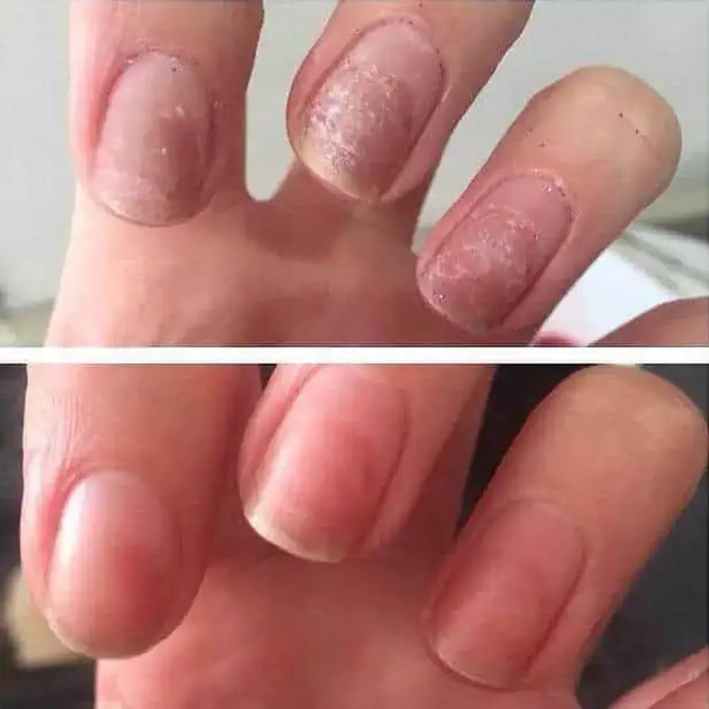 CND Rescue RXx Daily Nail Keratin Treatment 15ml